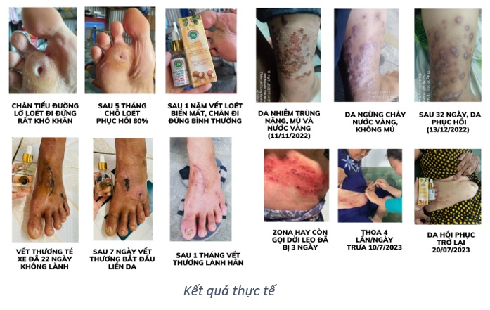 tinh chiet macca duong xuan qua cuu tinh cho da va toc 2